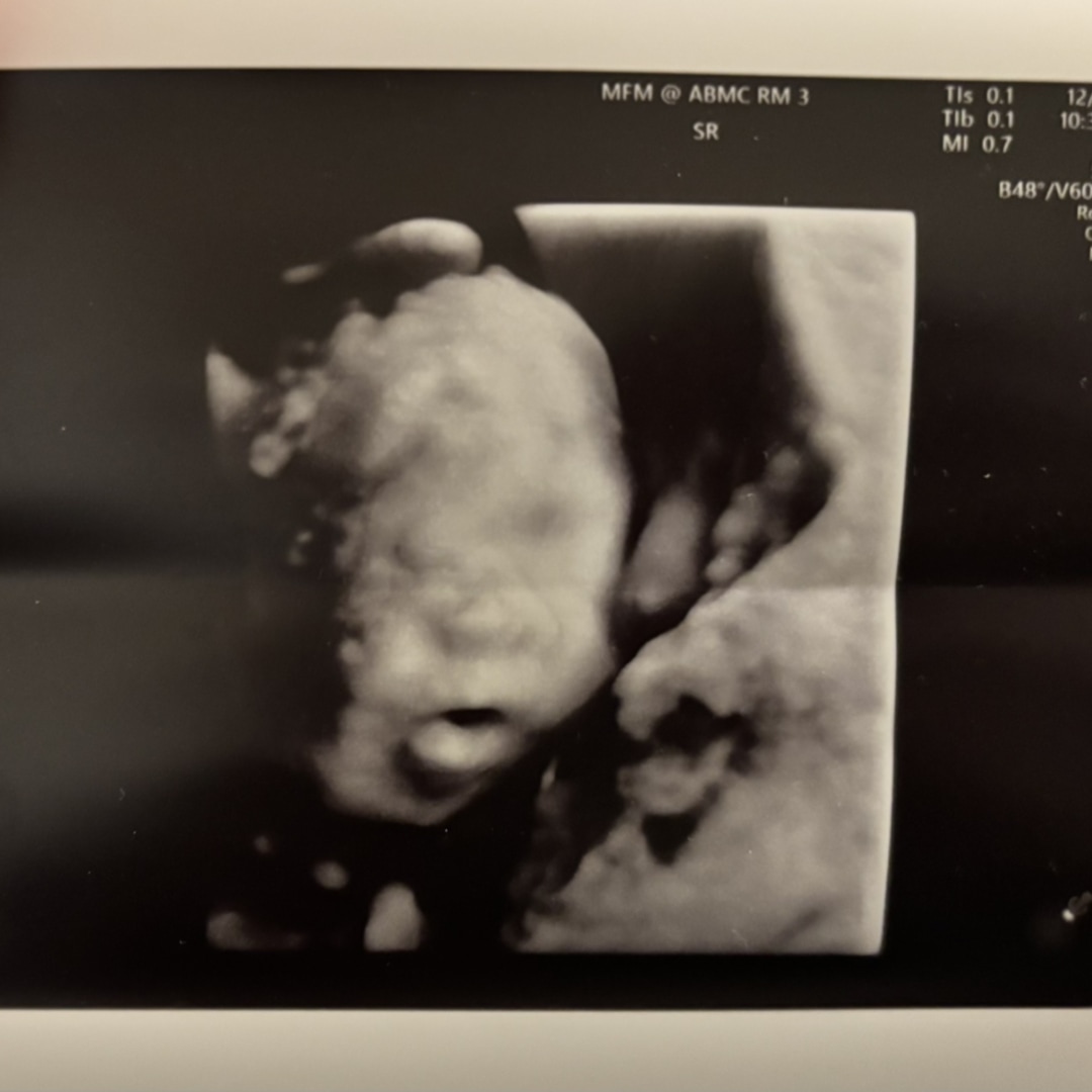 Photo shared by Caylie for their Babylist baby registry.