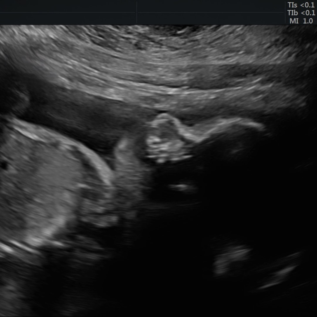 Photo shared by Emily for their Babylist baby registry.