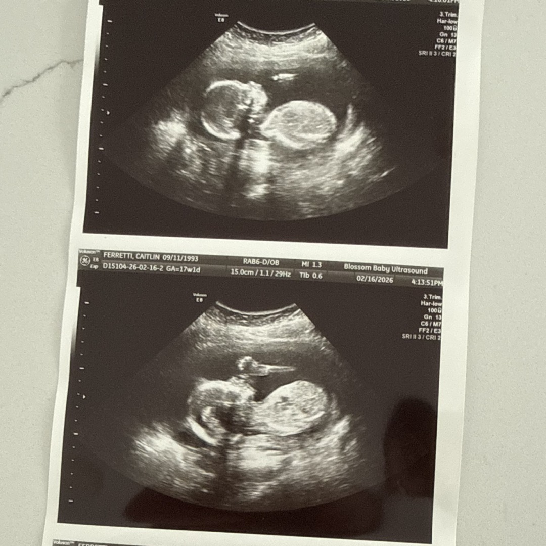 Photo shared by Caitlin for their Babylist baby registry.