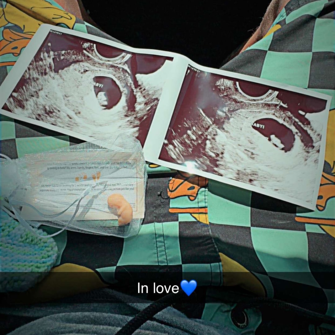 Photo shared by Aubrey for their Babylist baby registry.