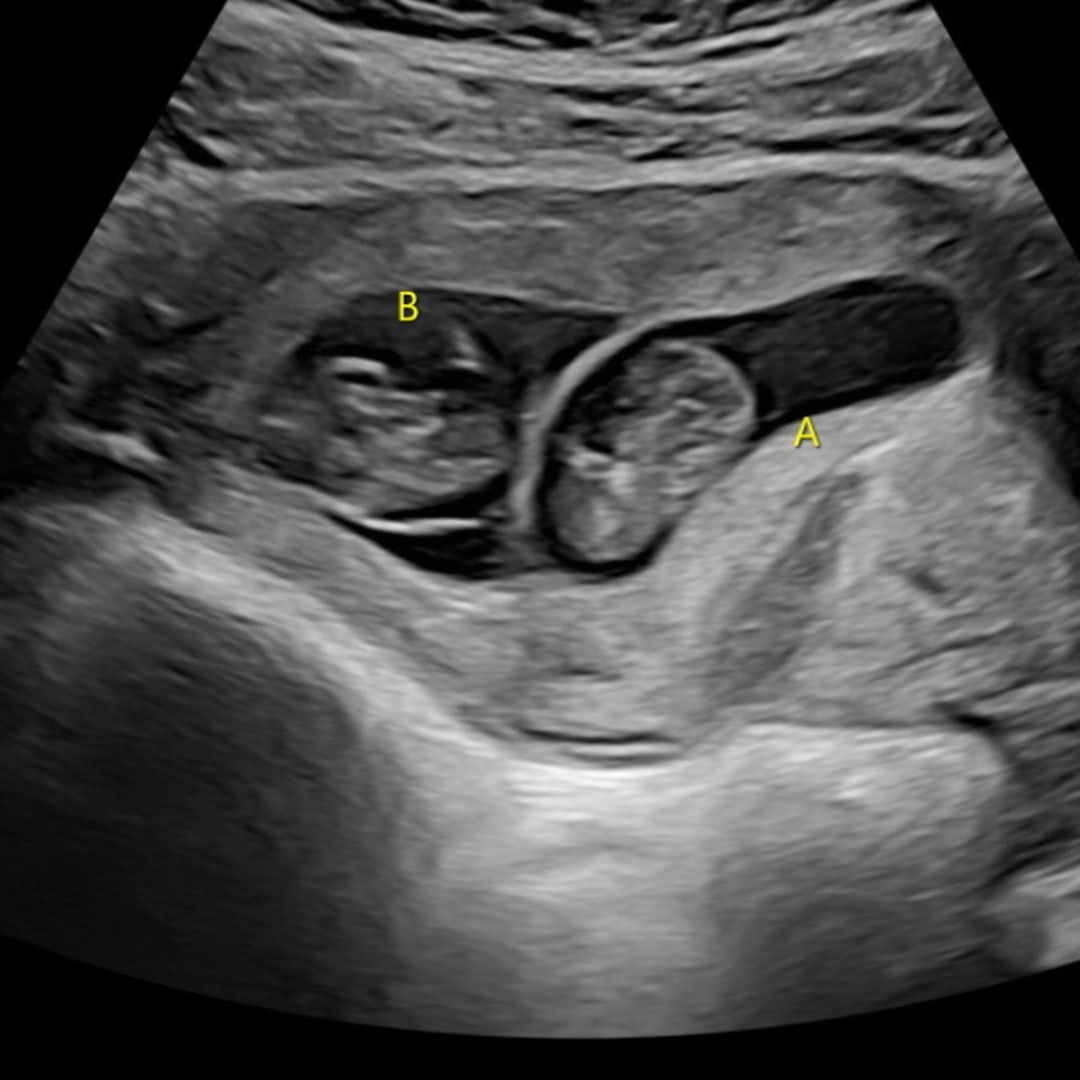 Photo shared by Braden for their Babylist baby registry.