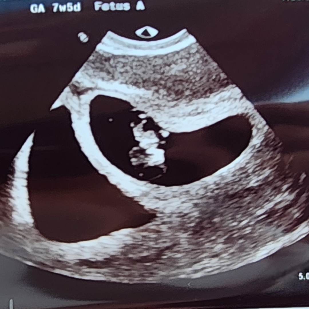 Photo shared by Casey for their Babylist baby registry.
