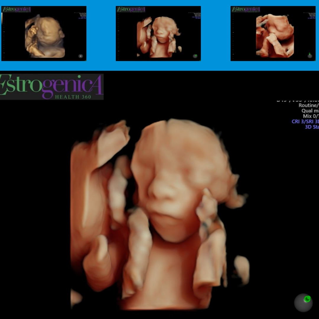 Photo shared by Madison for their Babylist baby registry.