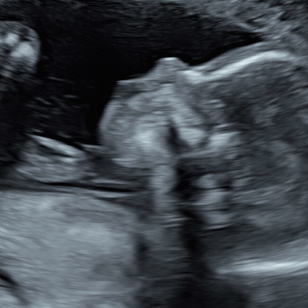 Photo shared by Karina for their Babylist baby registry.