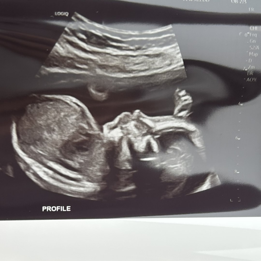 Photo shared by Collette for their Babylist baby registry.