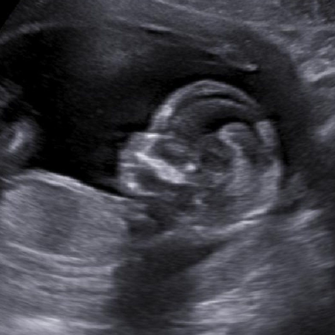 Photo shared by Lexi for their Babylist baby registry.