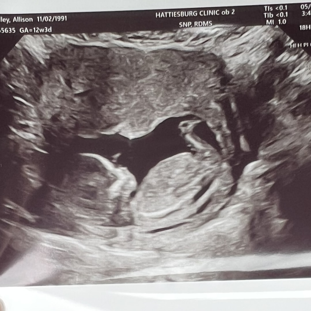 Photo shared by Allison for their Babylist baby registry.
