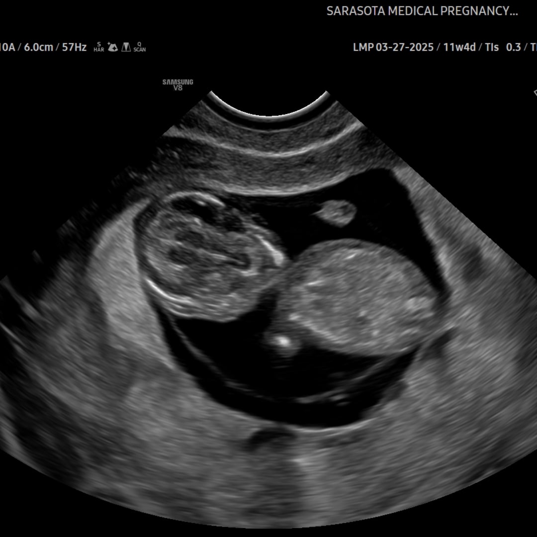 Photo shared by Elianis for their Babylist baby registry.
