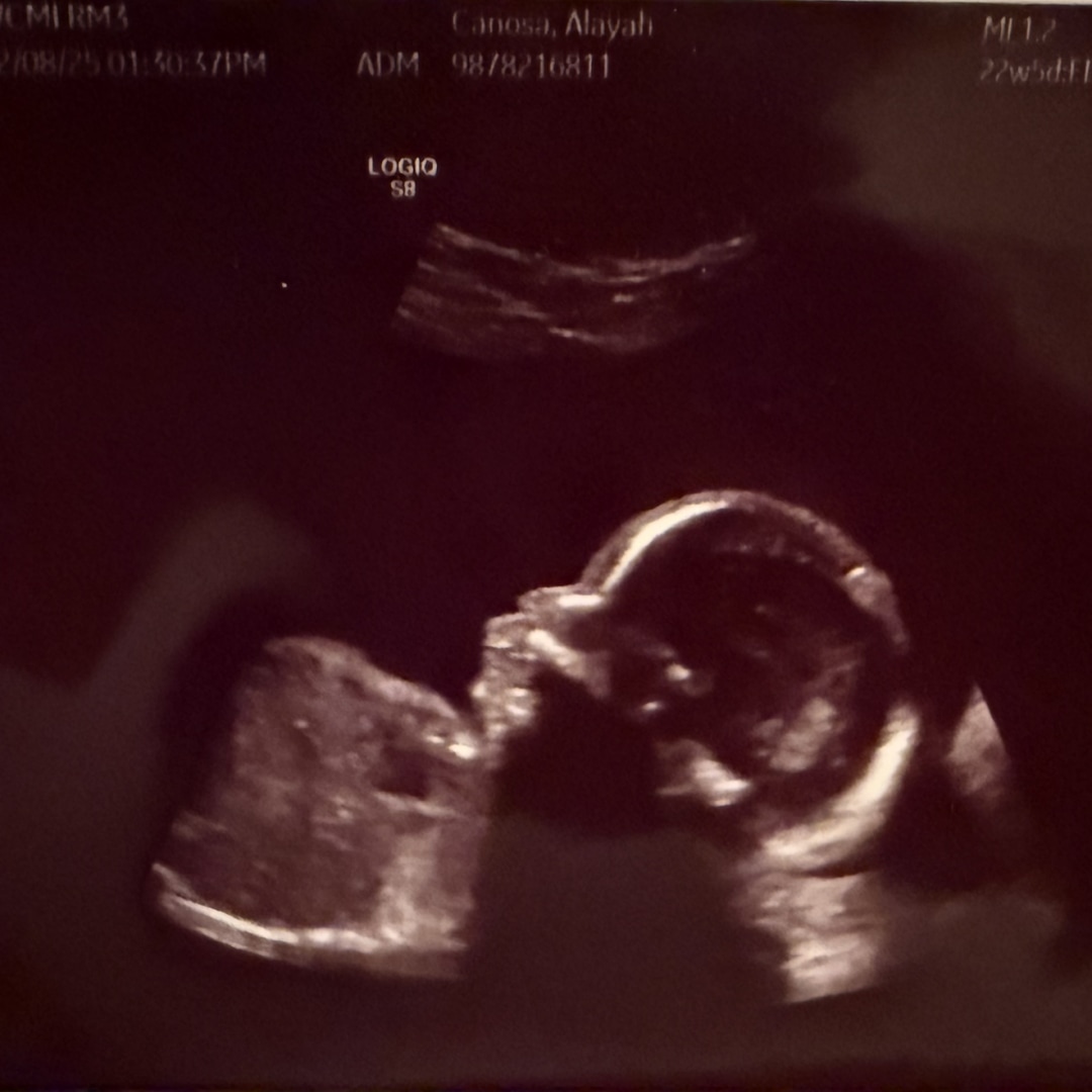 Photo shared by Alayah for their Babylist baby registry.