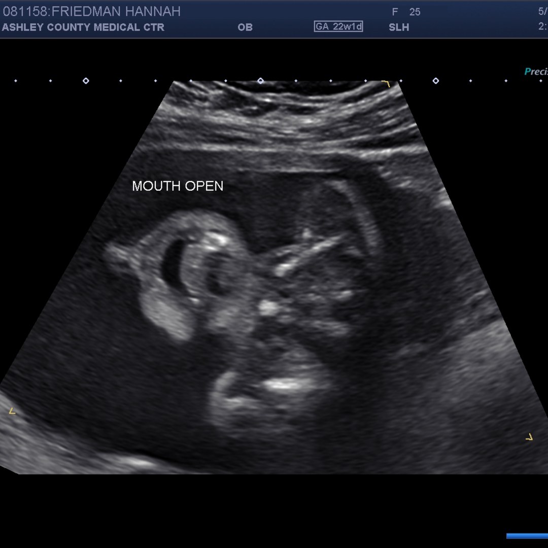 Photo shared by Hannah for their Babylist baby registry.