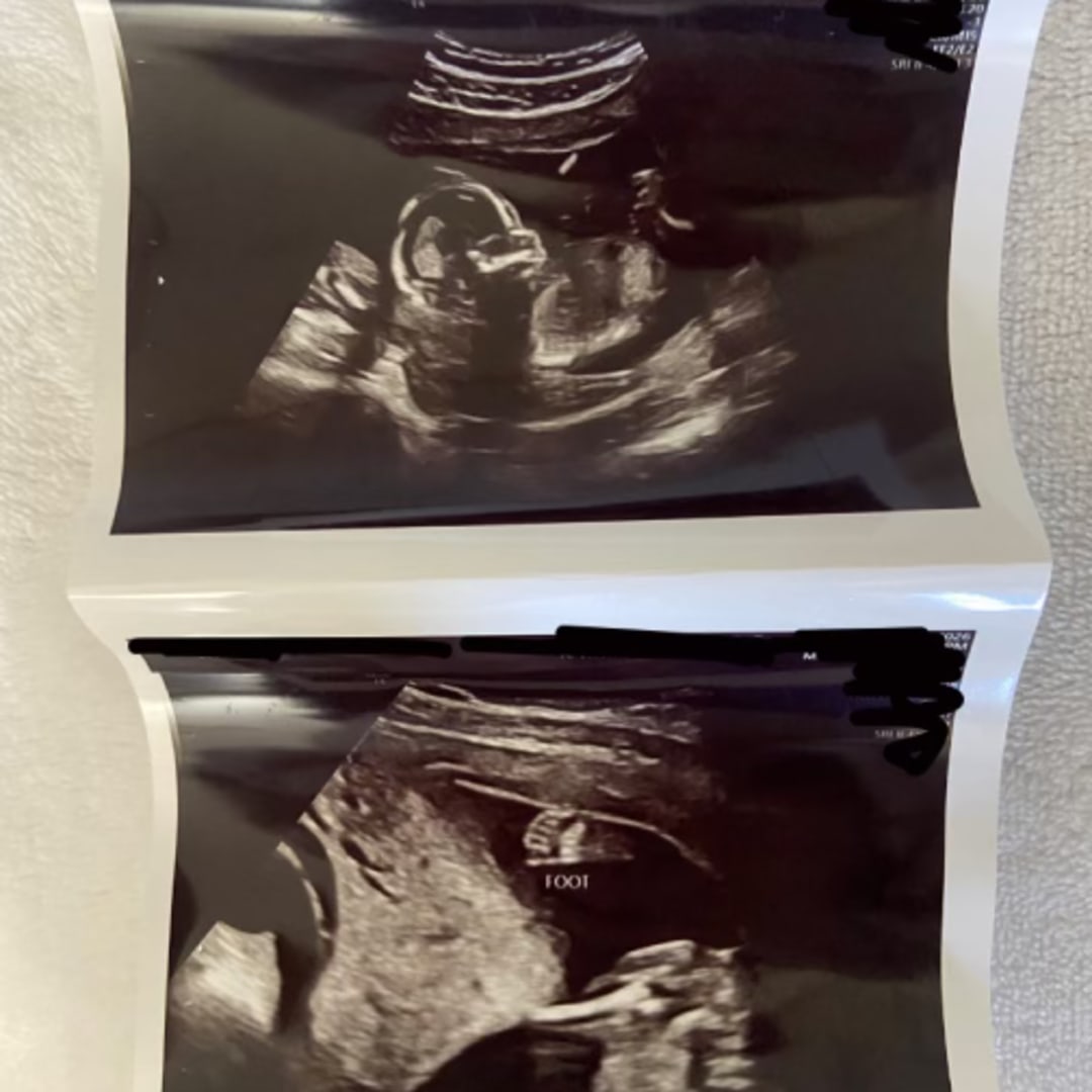 Photo shared by Madison for their Babylist baby registry.