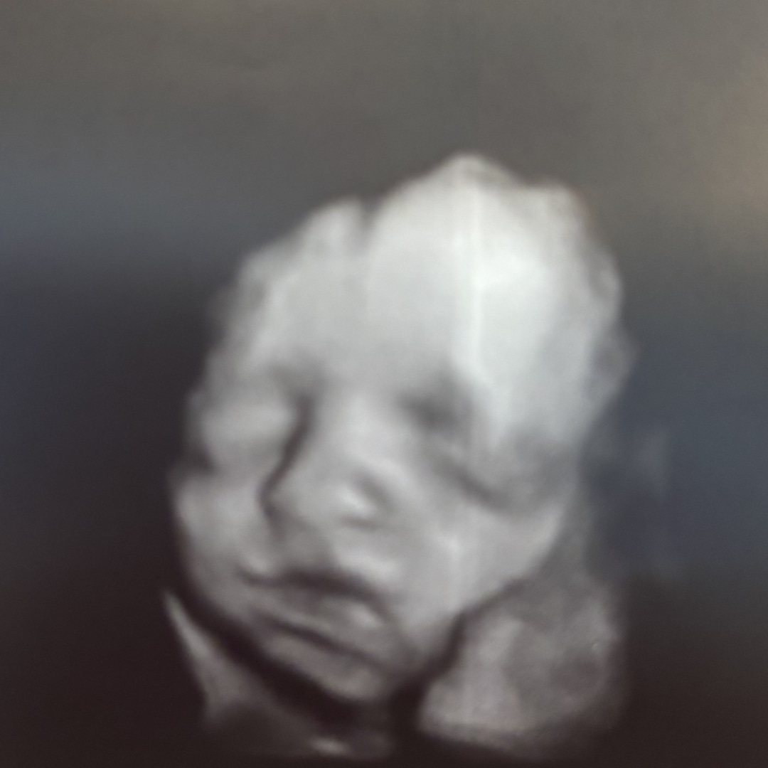 Photo shared by Abbie for their Babylist baby registry.
