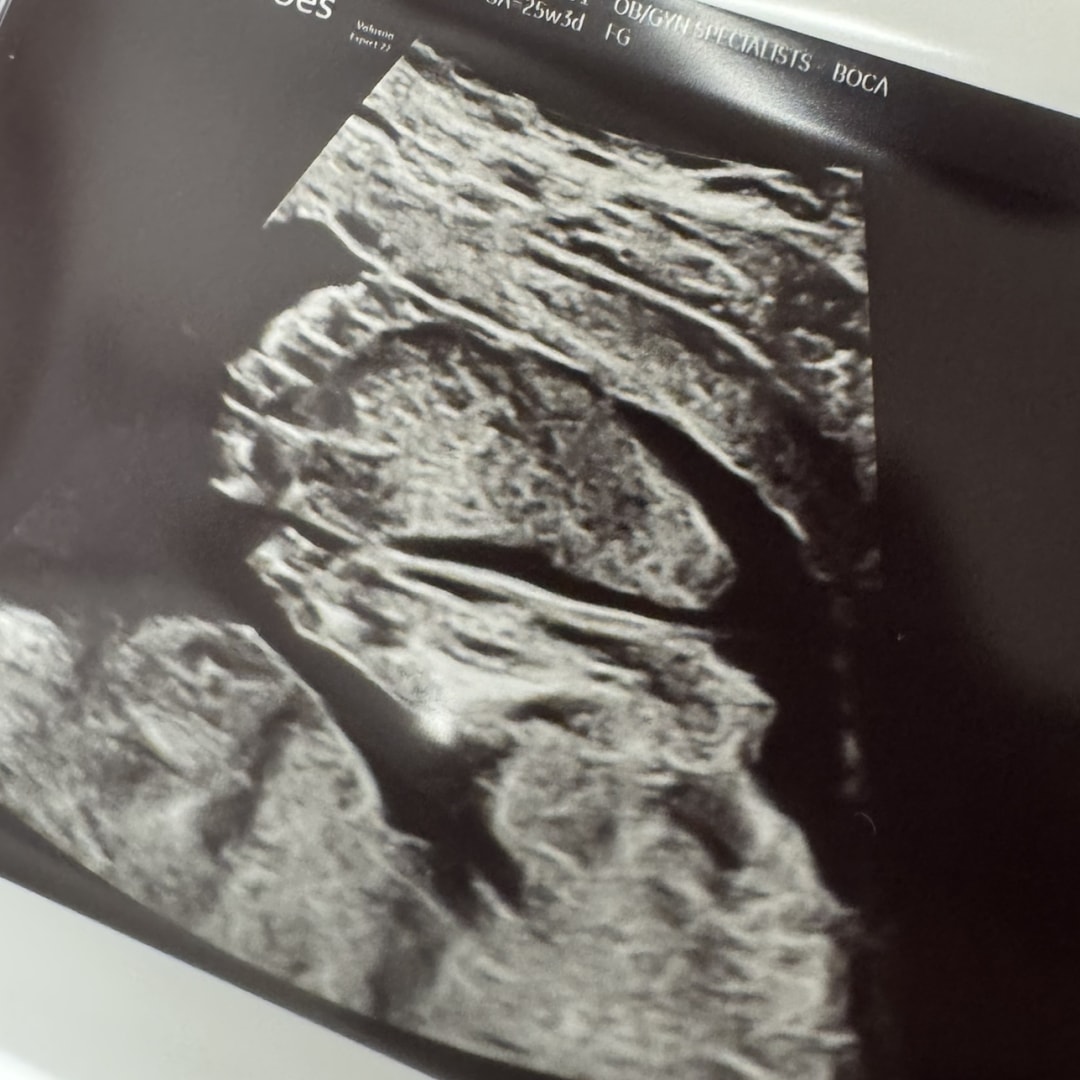 Photo shared by Cassandra for their Babylist baby registry.
