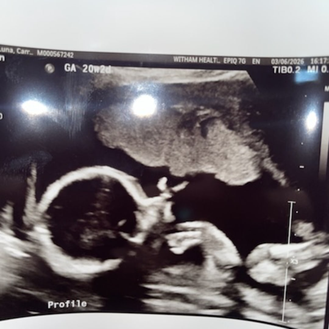 Photo shared by Camila for their Babylist baby registry.