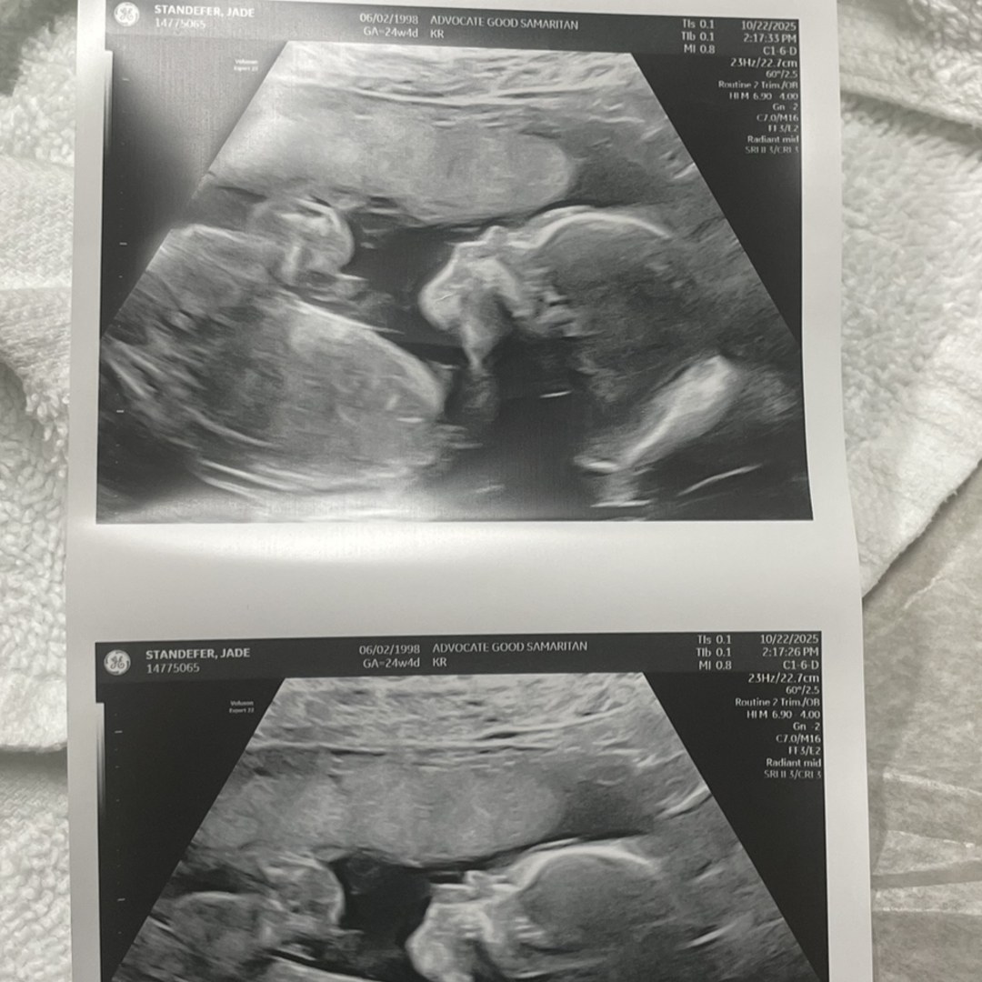 Photo shared by Jade for their Babylist baby registry.