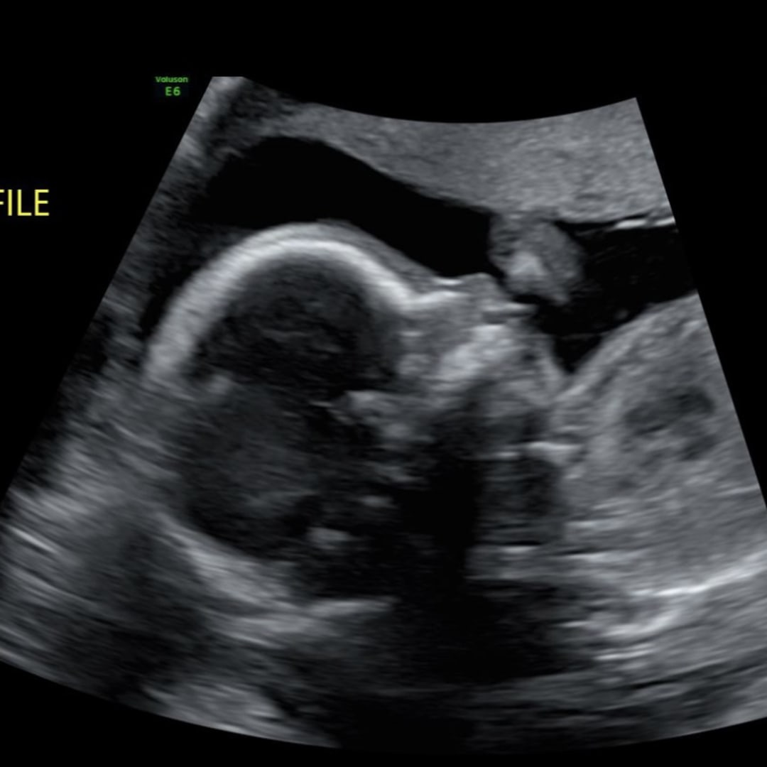 Photo shared by Sydney for their Babylist baby registry.