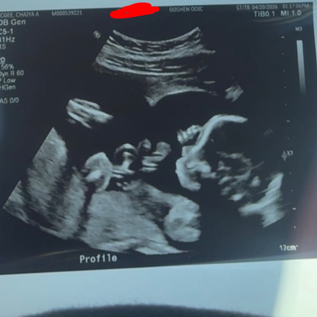Photo shared by Chaiya for their Babylist baby registry.
