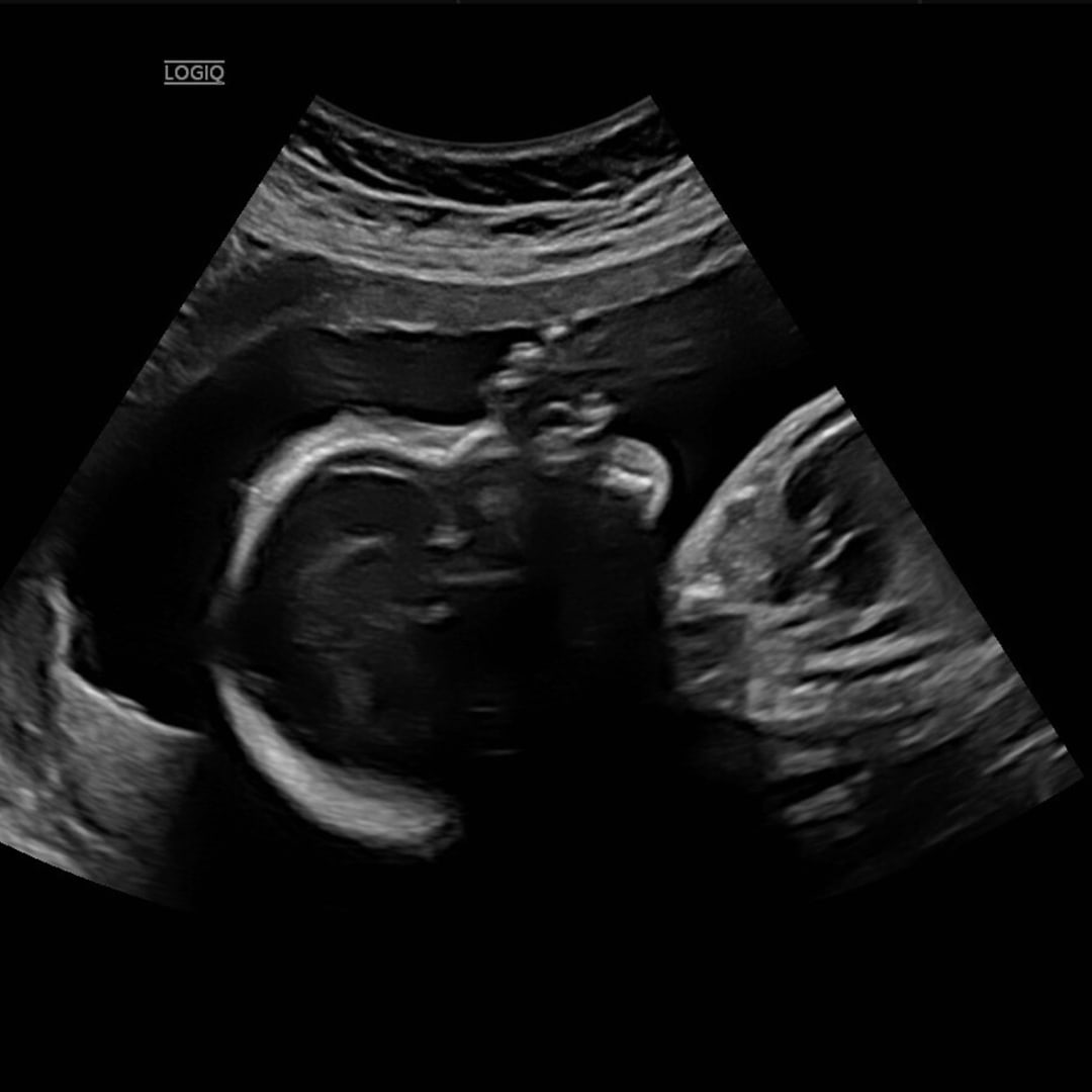 Photo shared by Jennifer for their Babylist baby registry.