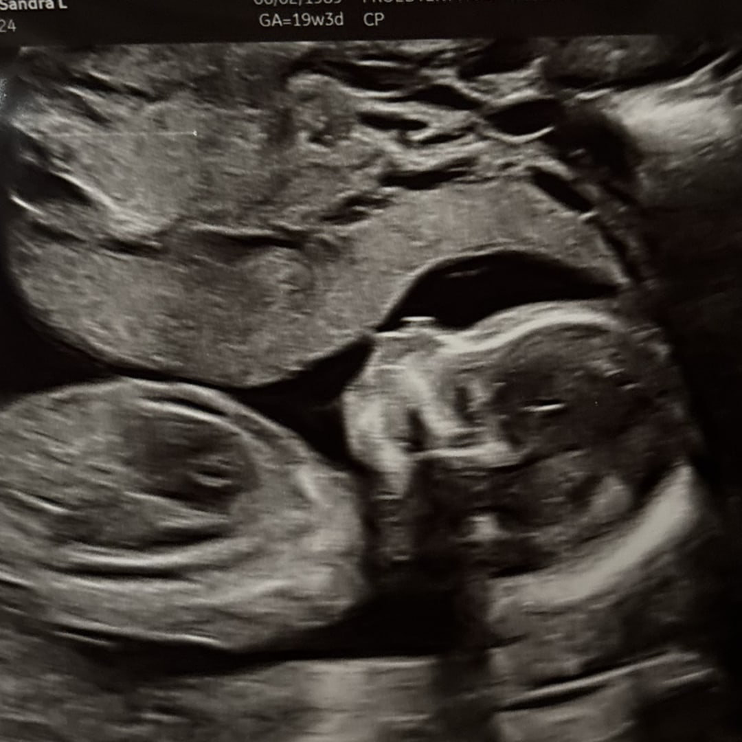 Photo shared by Sandra for their Babylist baby registry.