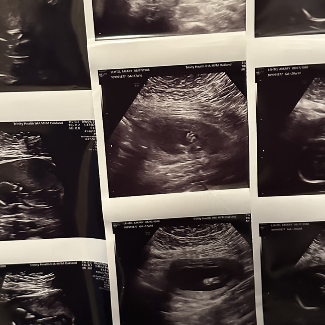 Photo shared by Amary for their Babylist baby registry.