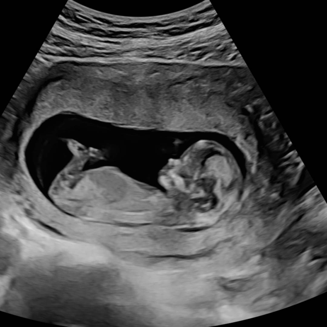 Photo shared by Kelsey for their Babylist baby registry.