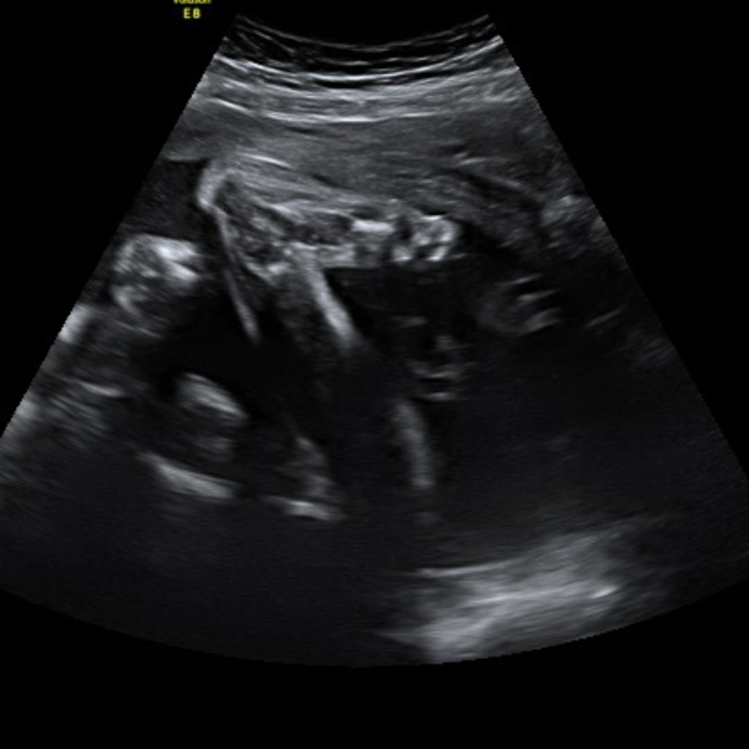 Photo shared by Tiffany for their Babylist baby registry.