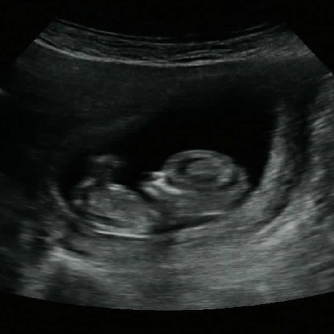 Photo shared by Breanna for their Babylist baby registry.