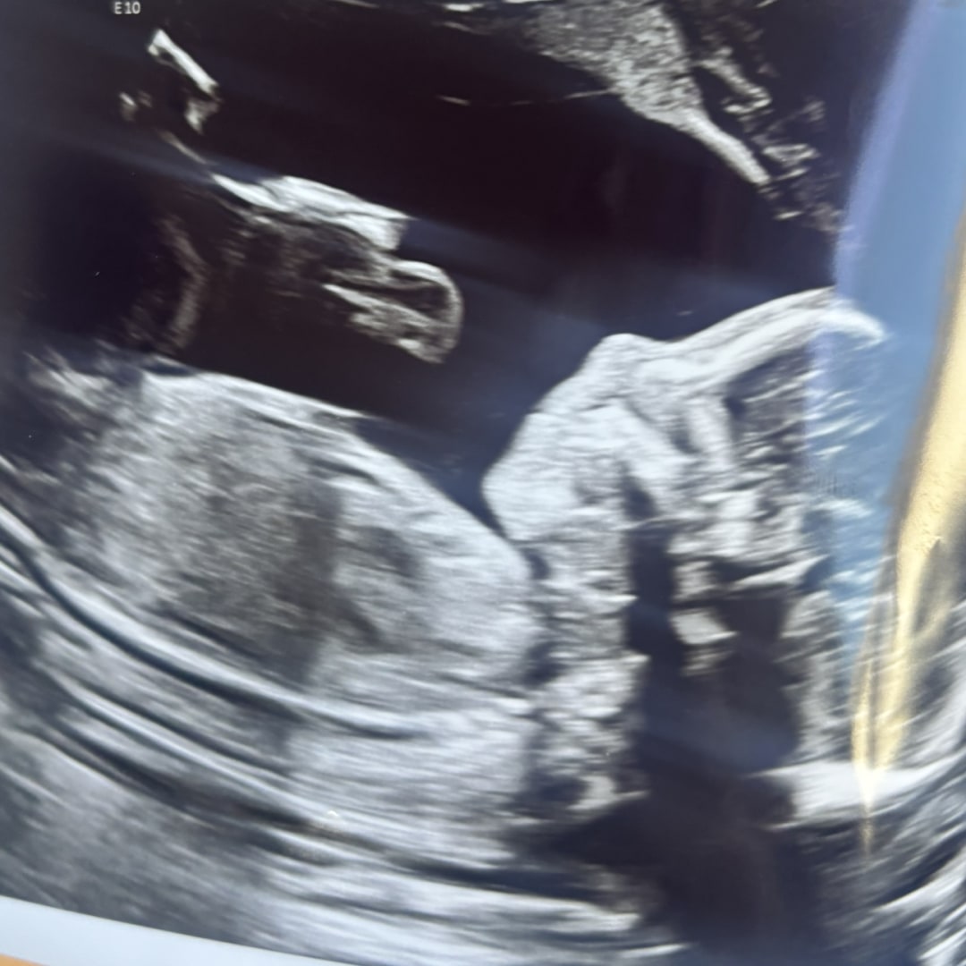 Photo shared by Ashley for their Babylist baby registry.