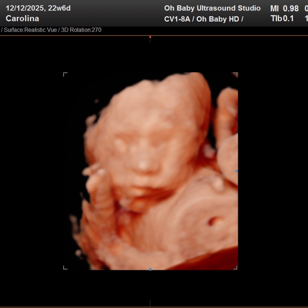 Photo shared by Carolina for their Babylist baby registry.