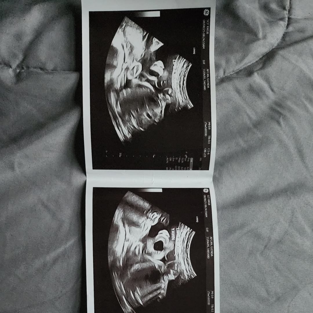 Photo shared by Glenda for their Babylist baby registry.