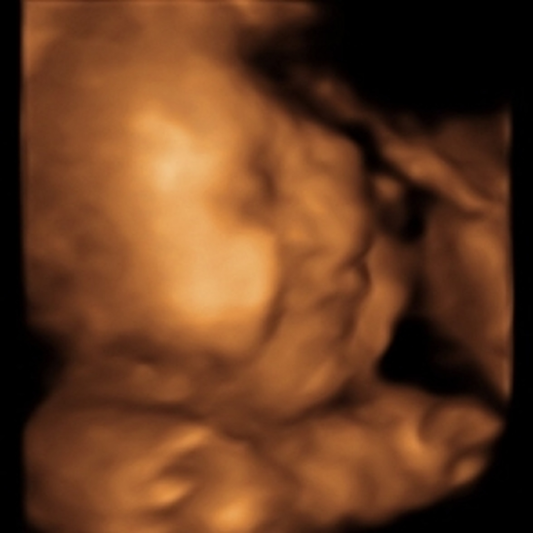 Photo shared by Kaitlyn for their Babylist baby registry.