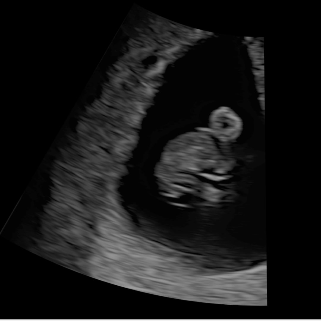 Photo shared by Alyssa for their Babylist baby registry.