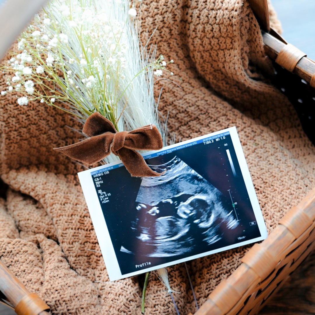 Photo shared by Jacquelyn for their Babylist baby registry.