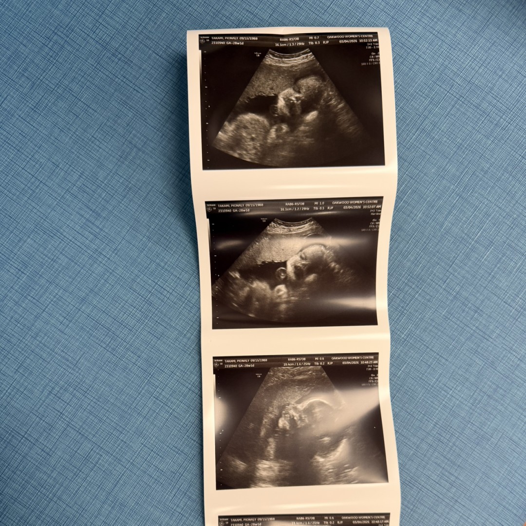 Photo shared by Pionaly for their Babylist baby registry.