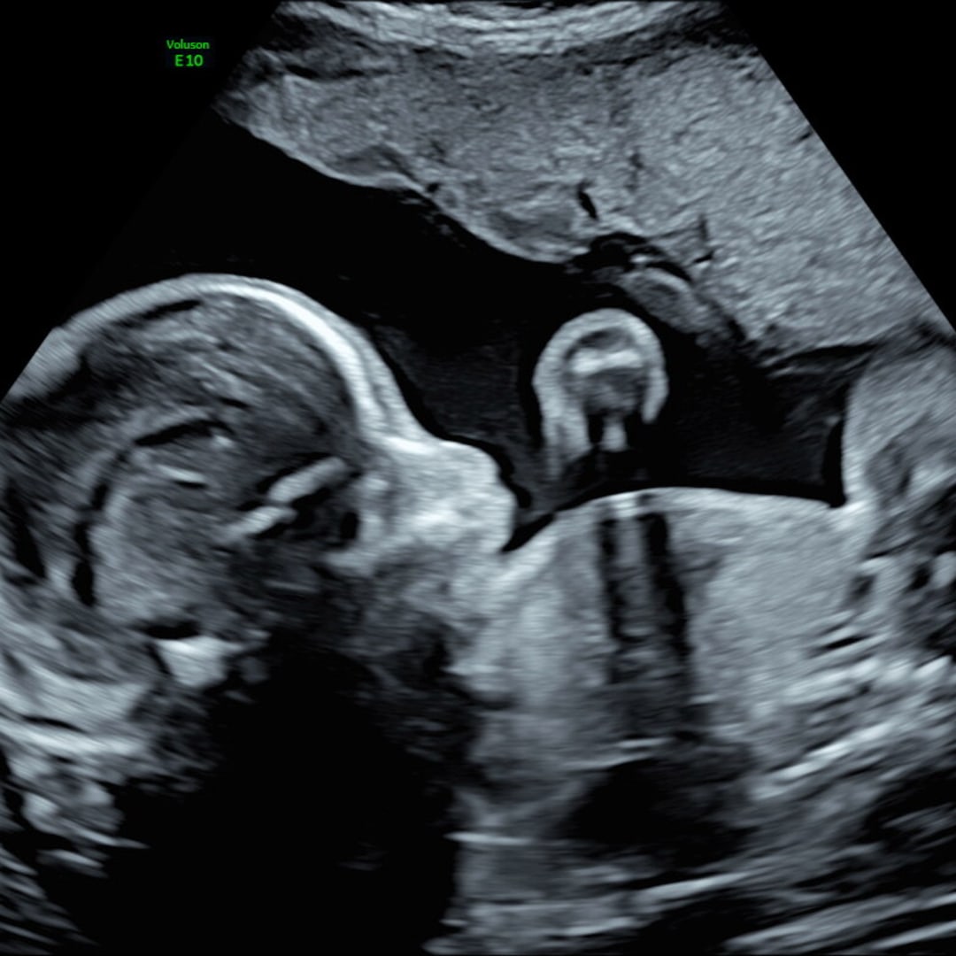 Photo shared by Maggie for their Babylist baby registry.