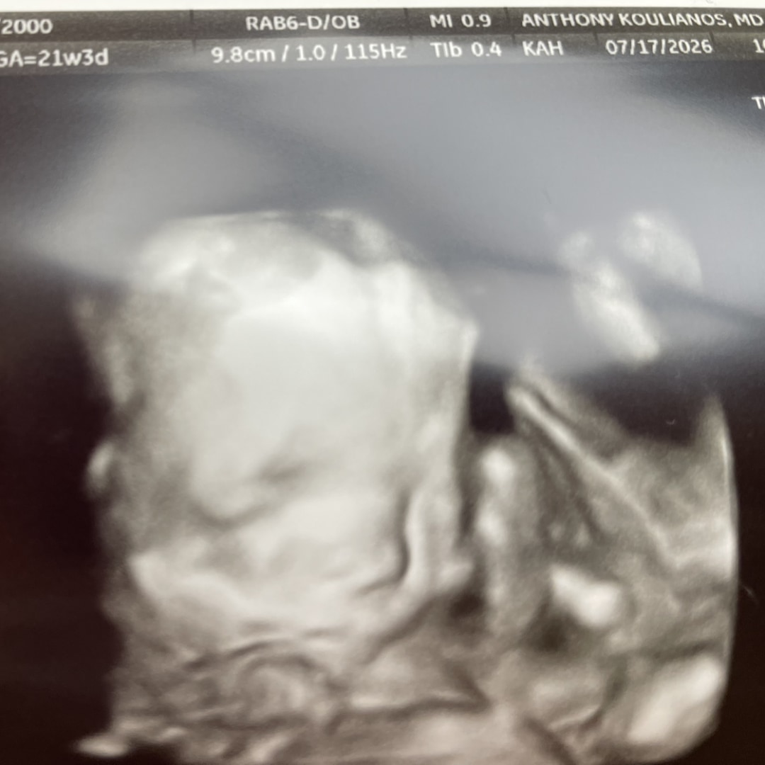 Photo shared by Alison for their Babylist baby registry.