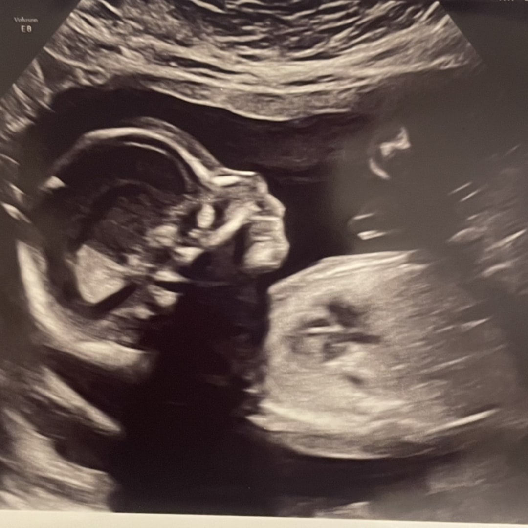 Photo shared by Ansley for their Babylist baby registry.