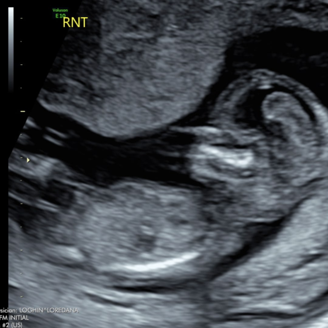 Photo shared by Kayla for their Babylist baby registry.