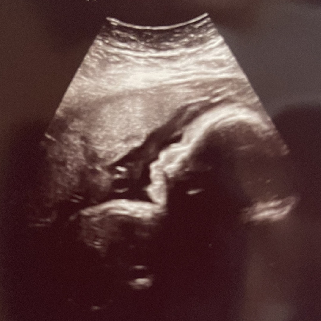 Photo shared by Stephanie for their Babylist baby registry.