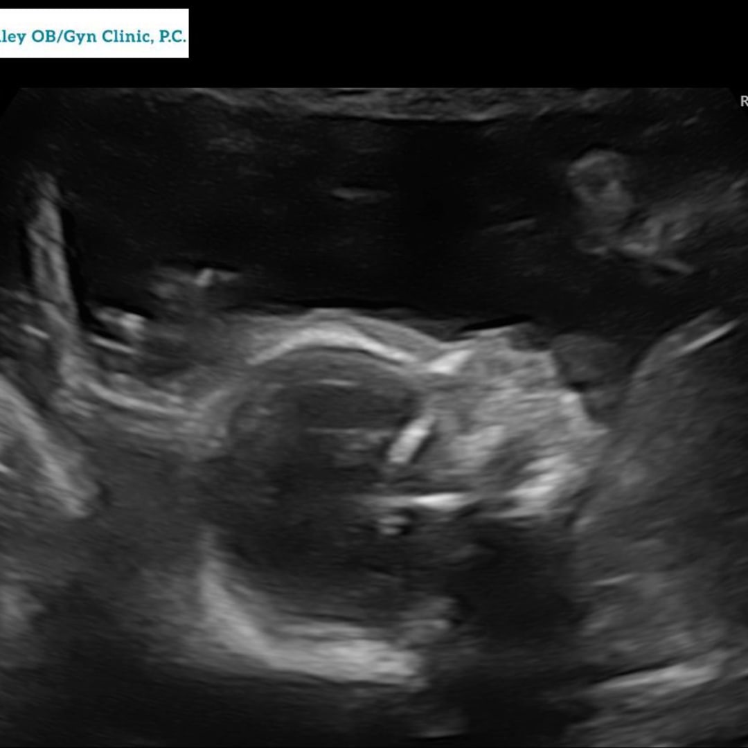 Photo shared by Carly for their Babylist baby registry.