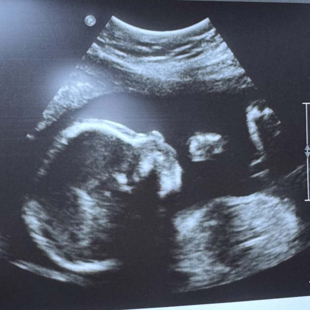 Photo shared by Haley & Levi for their Babylist baby registry.
