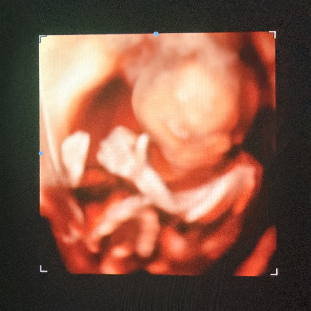 Photo shared by Justice for their Babylist baby registry.