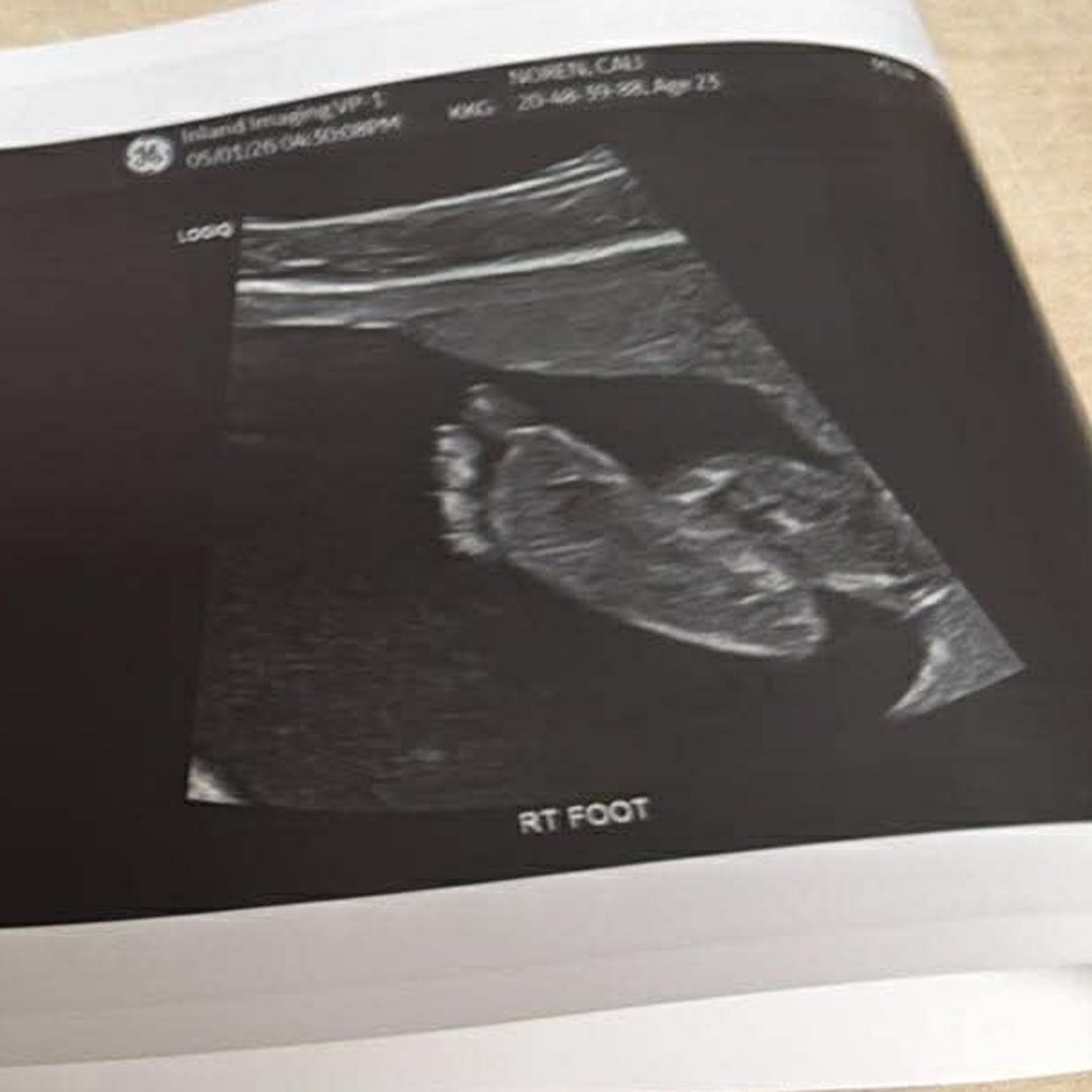 Photo shared by Cali for their Babylist baby registry.