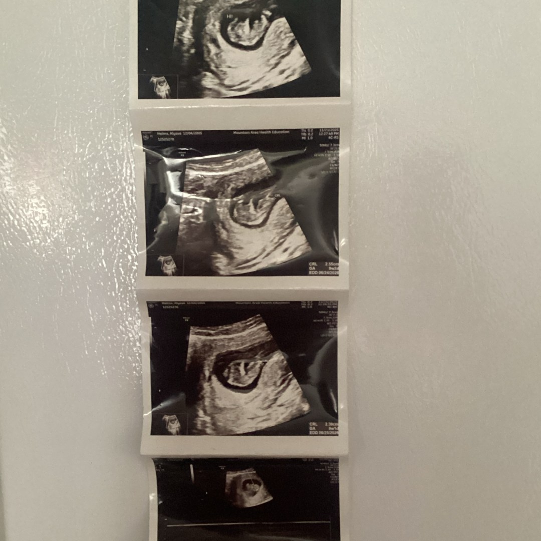 Photo shared by Alyssa for their Babylist baby registry.