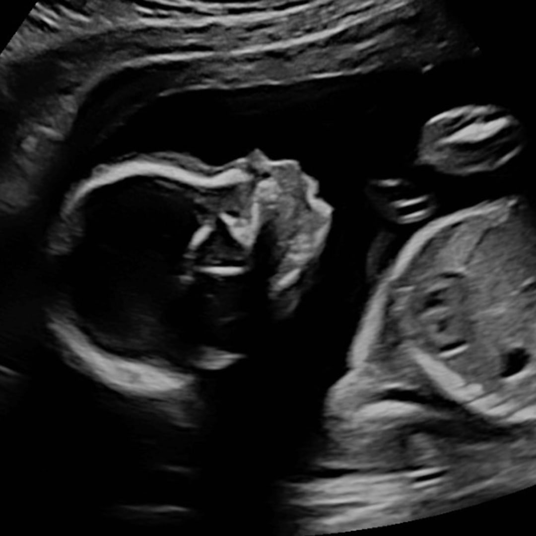 Photo shared by Kate for their Babylist baby registry.