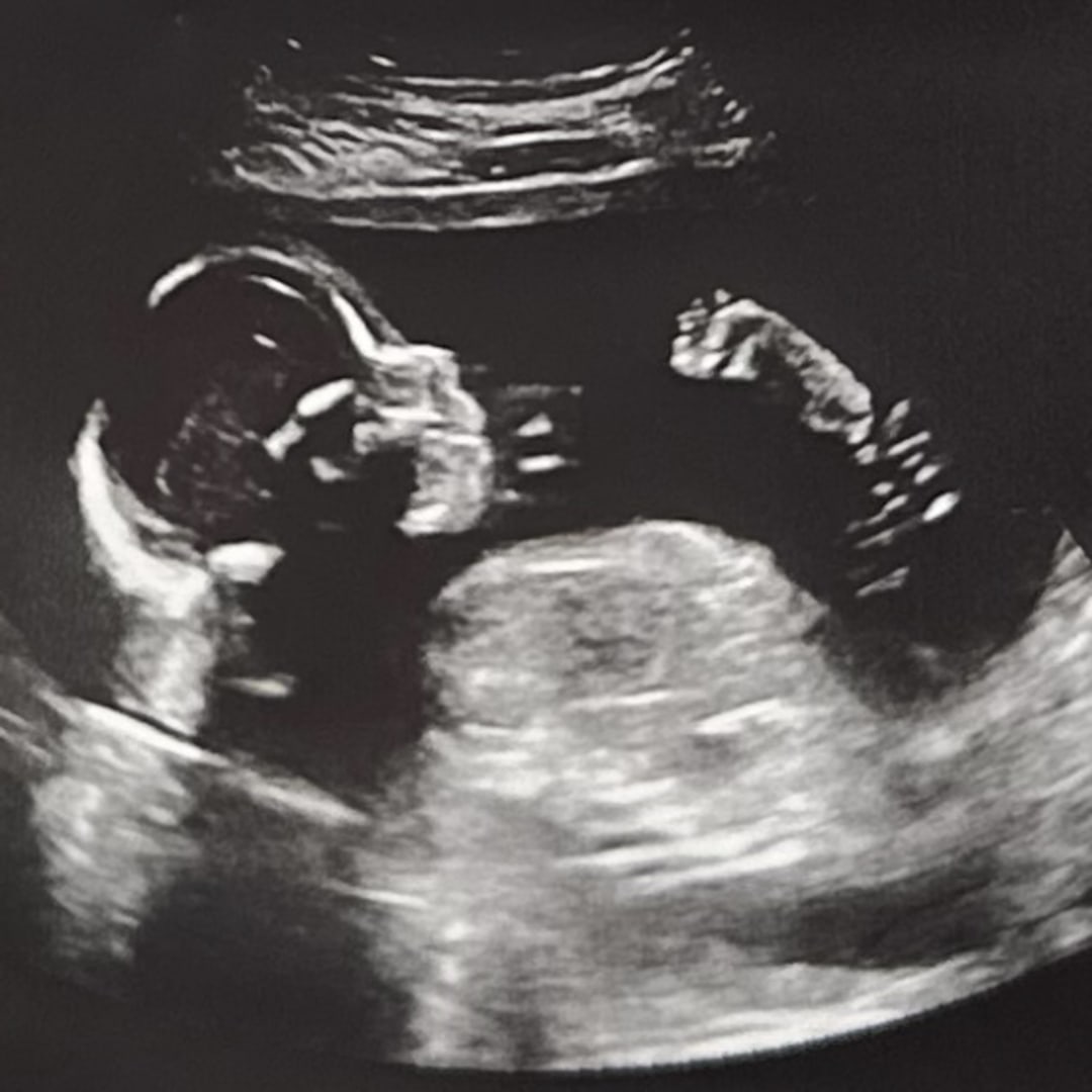 Photo shared by Madeline for their Babylist baby registry.