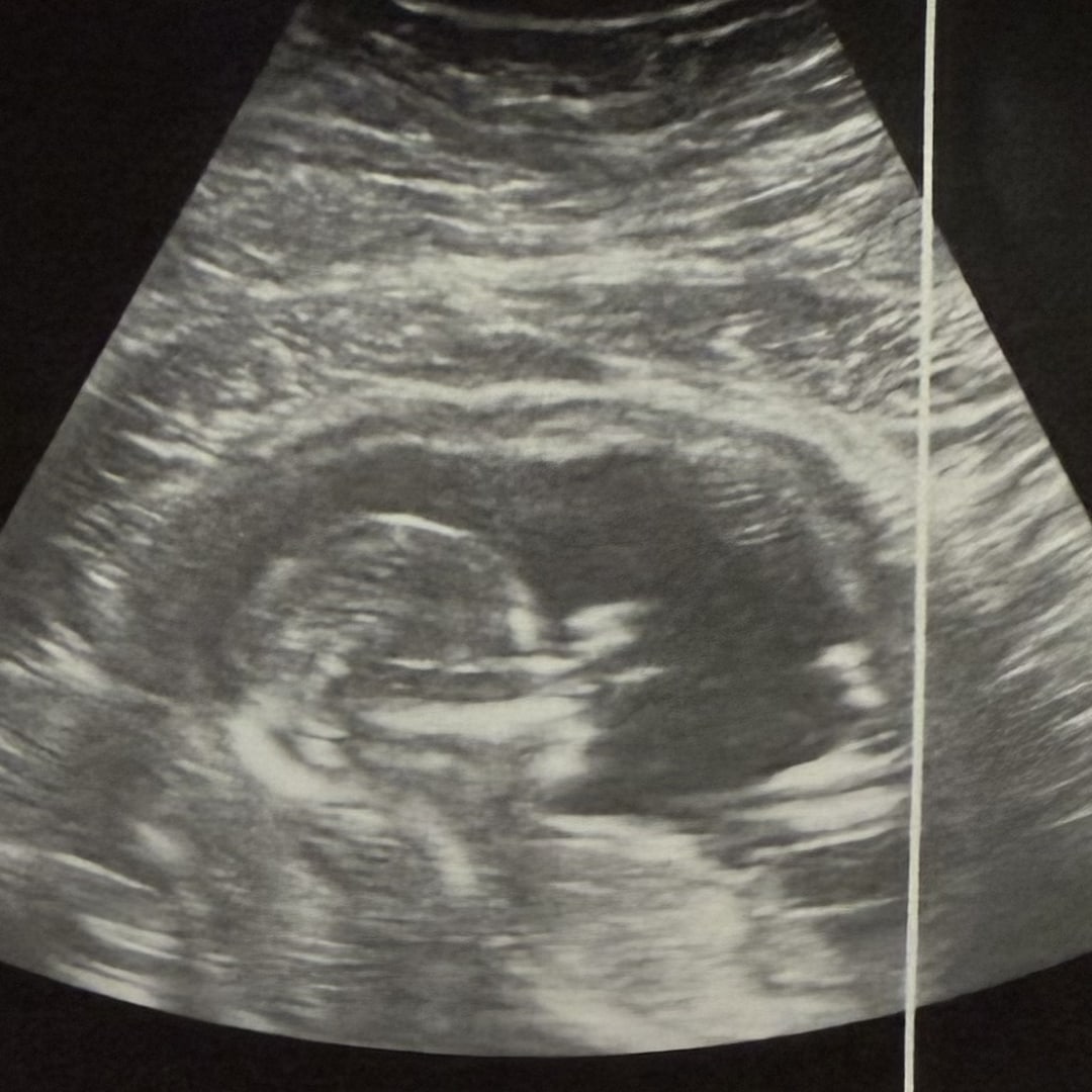 Photo shared by Alma for their Babylist baby registry.