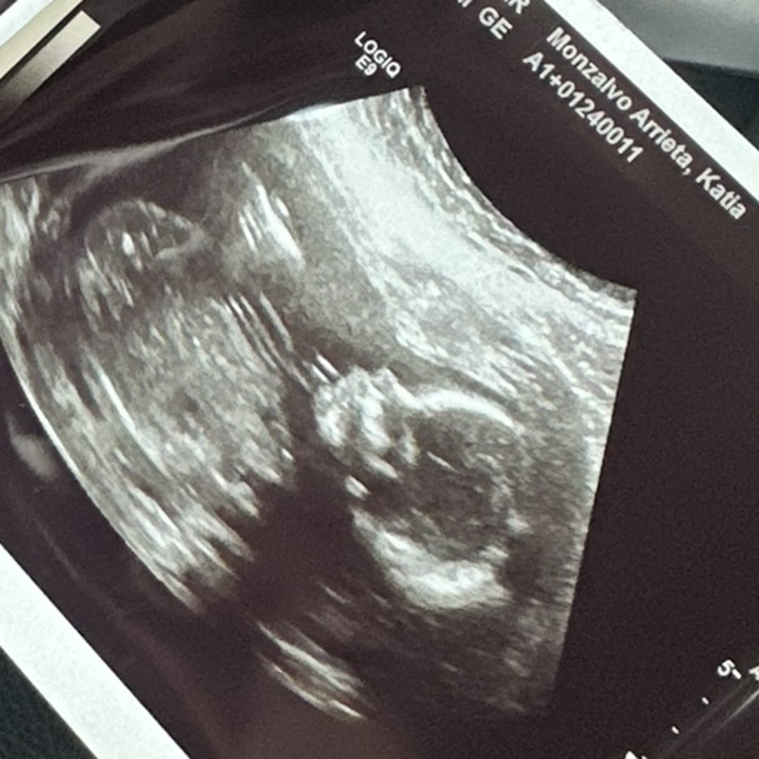 Photo shared by Katia for their Babylist baby registry.