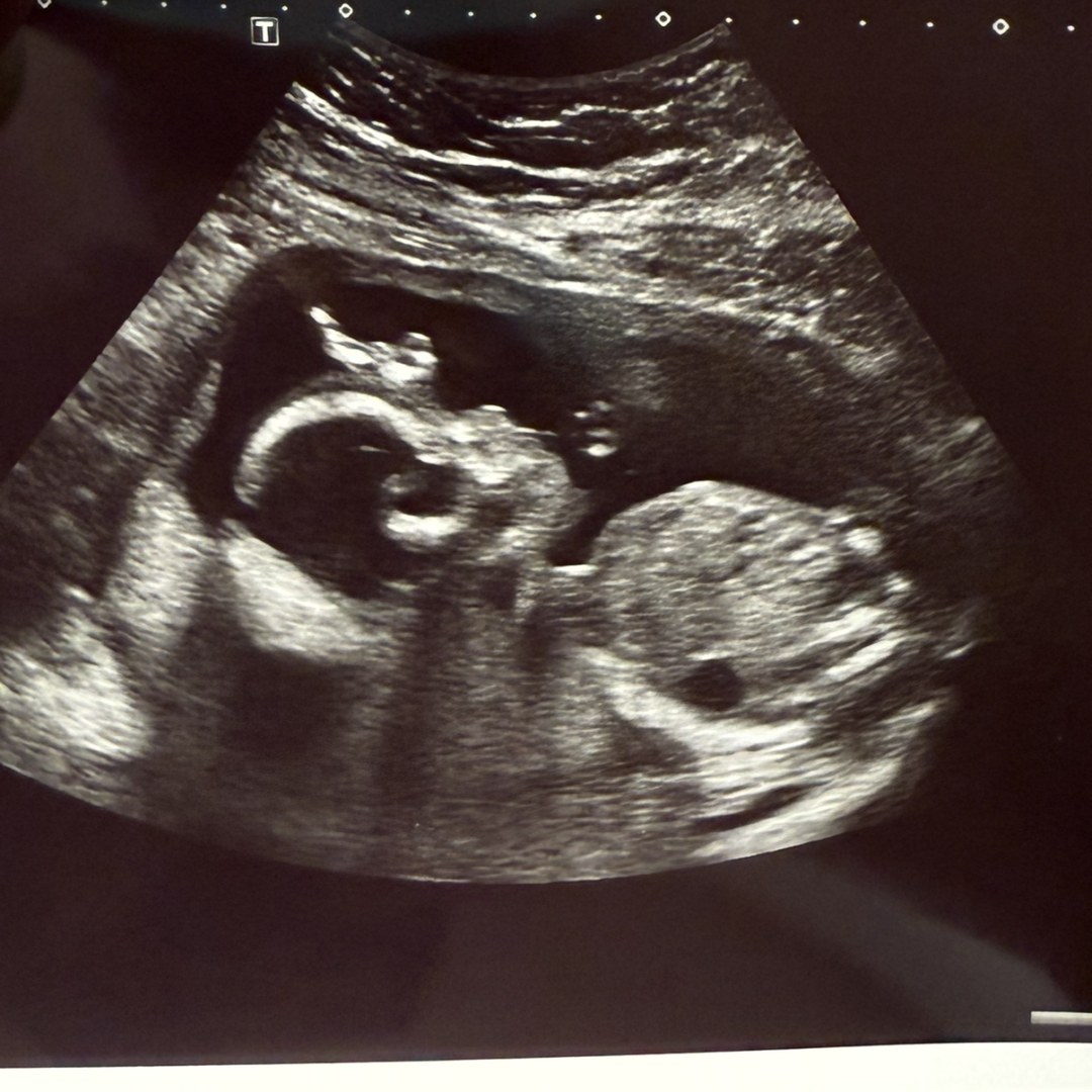 Photo shared by Ashley for their Babylist baby registry.