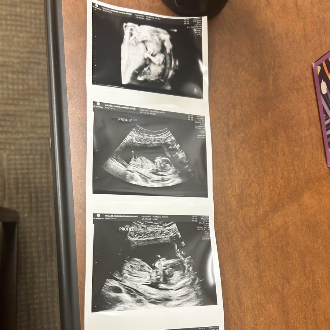 Photo shared by Shakira for their Babylist baby registry.